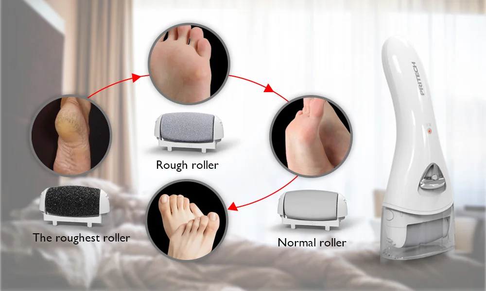 Electric Callus Remover